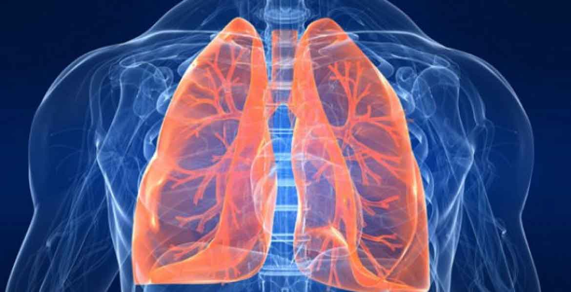 Asbestos Diseases